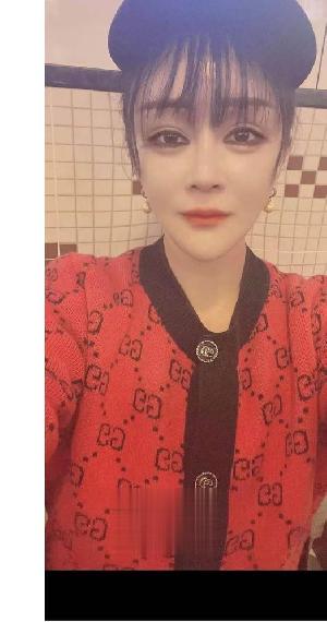 昆明整容，服务很顶